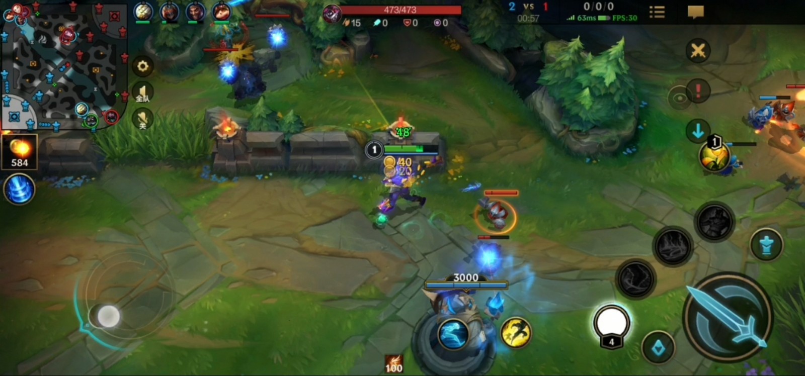 英雄联盟手游可以反向技能接闪